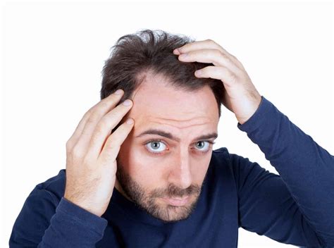 Top Hair Loss Treatments For Men
