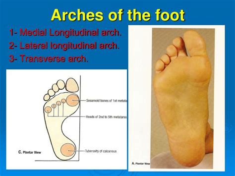 Ppt Arches Of The Foot Powerpoint Presentation Free Download Id