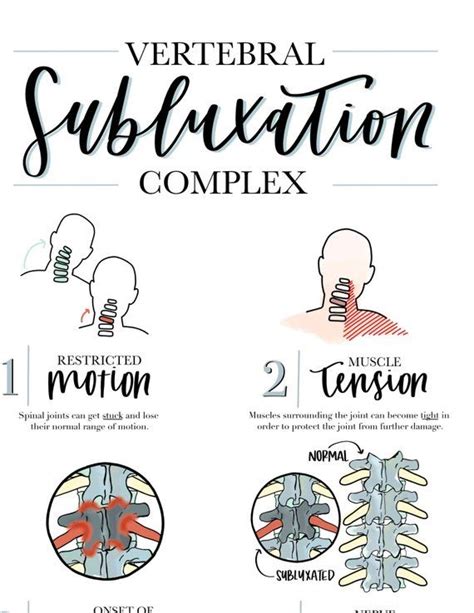 Vertebral Subluxation Complex Chiropractic Poster Watercolor Etsy In