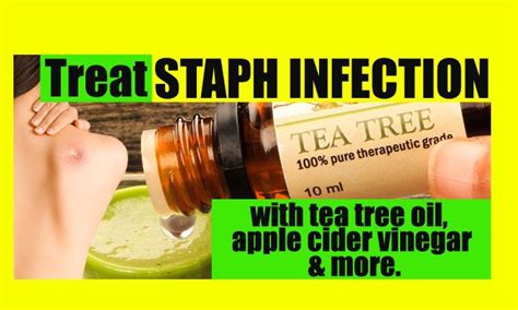 Home Remedies For Staph Infection Page 2 Of 3 Top 10 Home Remedies