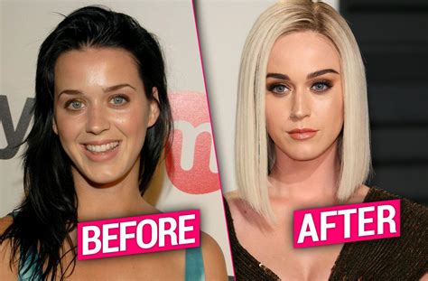 Katy Perrys Plastic Surgery Lies Star S Had Work Done Top Docs Say