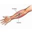 Forearm Fracture  Causes Symptoms And Treatment