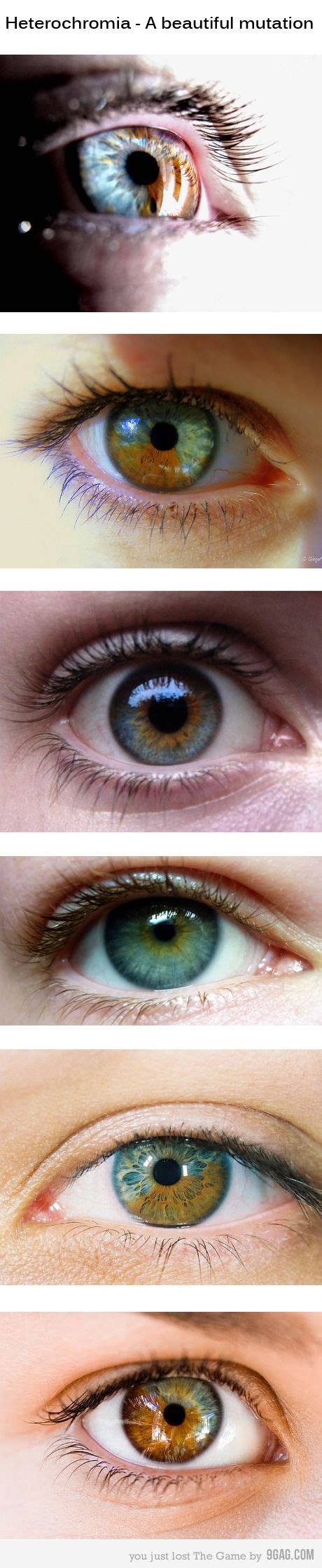 Heterochromia A Beautiful Mutation Heterochromia Is Relatively Rare It Affects Around 11 In