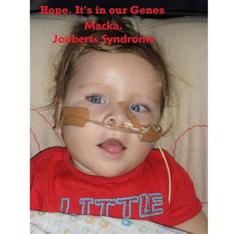 Despite Mackas Challenges From Joubert Syndrome His Parents Are
