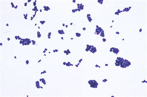 Gram Positive Cocci Microbiology Learning The Why Ology Of
