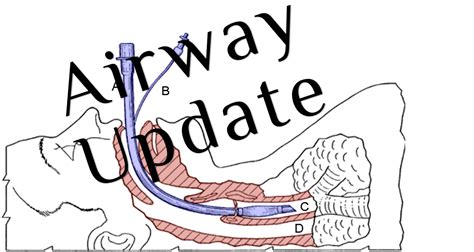 EMCrit Podcast 226 - Airway Update - Bougie and Positioning