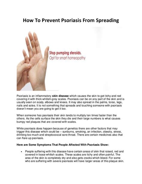 How To Prevent Psoriasis From Spreading