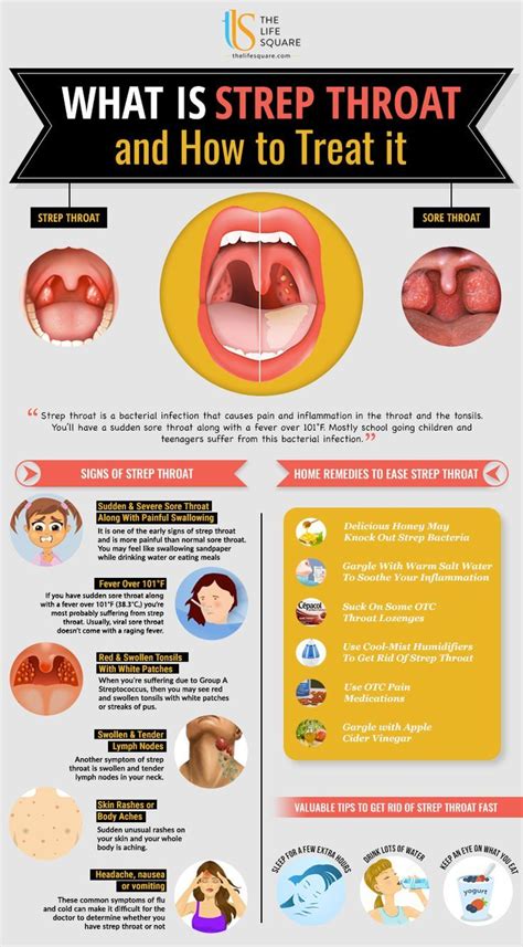 How To Treat Sore Throat