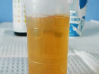 We did not find results for: Polyuria - Frequent Urination Symptoms and Causes