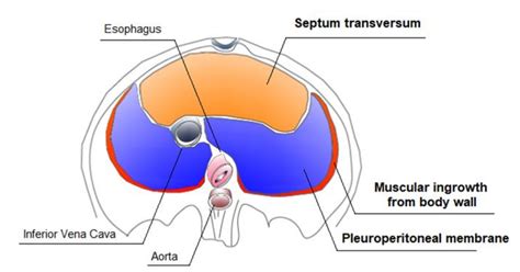 Ijms Free Full Text Management Of Congenital Diaphragmatic Hernia