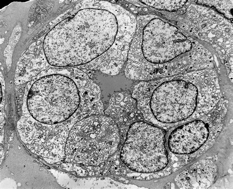 Um Pesquisador Estudou Uma Célula Ao Microscópio Eletrônico