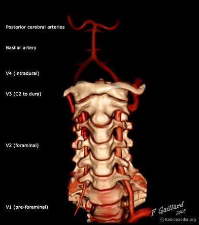 Vertebral Artery Radiology Reference Article Radiopaedia Org