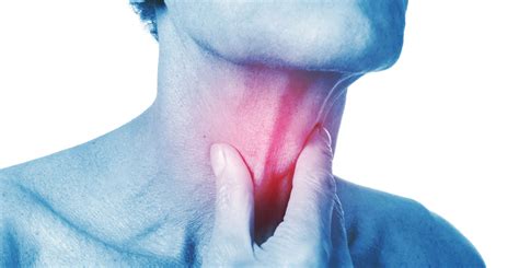 Is It A Sore Throat Or Strep Throat Upmc Myhealth Matters