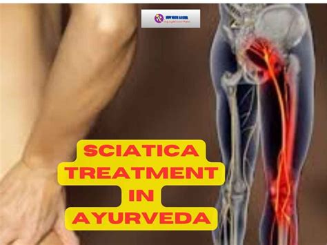 sciatica treatment in ayurveda