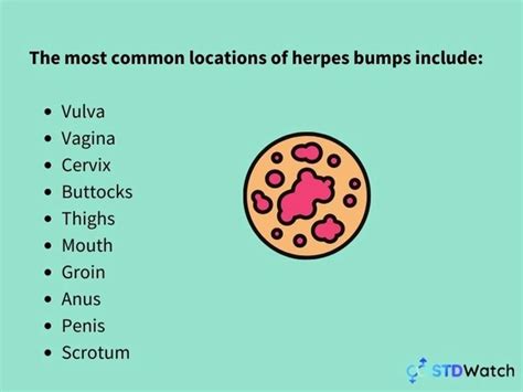 Ingrown Hairs Vs Herpes Whats The Difference