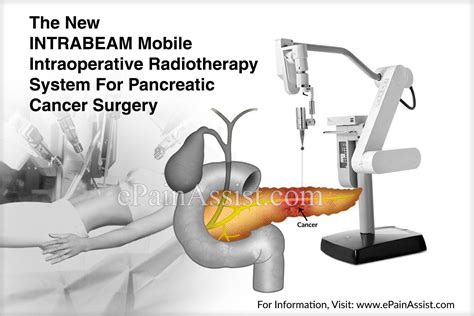 The New Intrabeam Mobile Intraoperative Radiotherapy System For