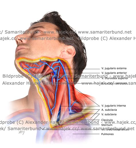 The brachiocephalic artery, the left common carotid artery, and the left subclavian artery. Neck Vessels Gallery