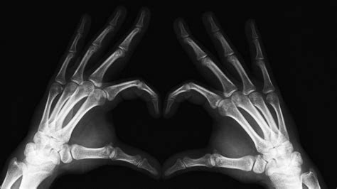 Radiography Wallpapers Top Free Radiography Backgrounds Wallpaperaccess