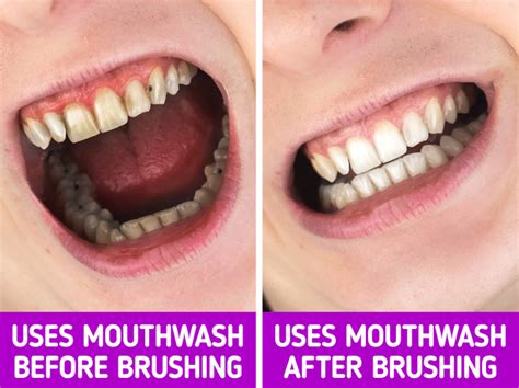 5 things that might happen to your body if you use mouthwash every day