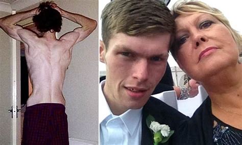 Mother Broken After Watching Teenage Son Starve Himself Daily Mail
