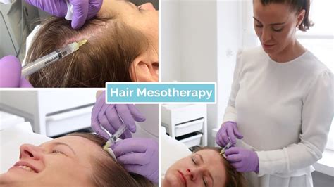Hair Loss Mesotherapy The Laser And Skin Clinic Youtube