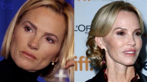 Janet Gretzkys Plastic Surgery Do You Know She Is 62 Years Old