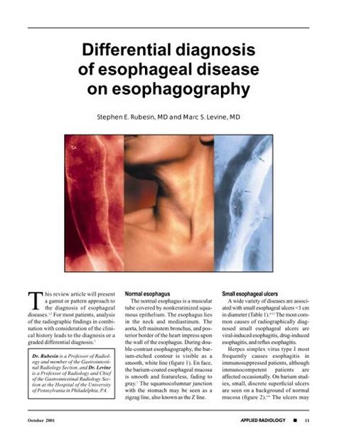 Differential Diagnosis Of Esophageal Disease On Esophagography