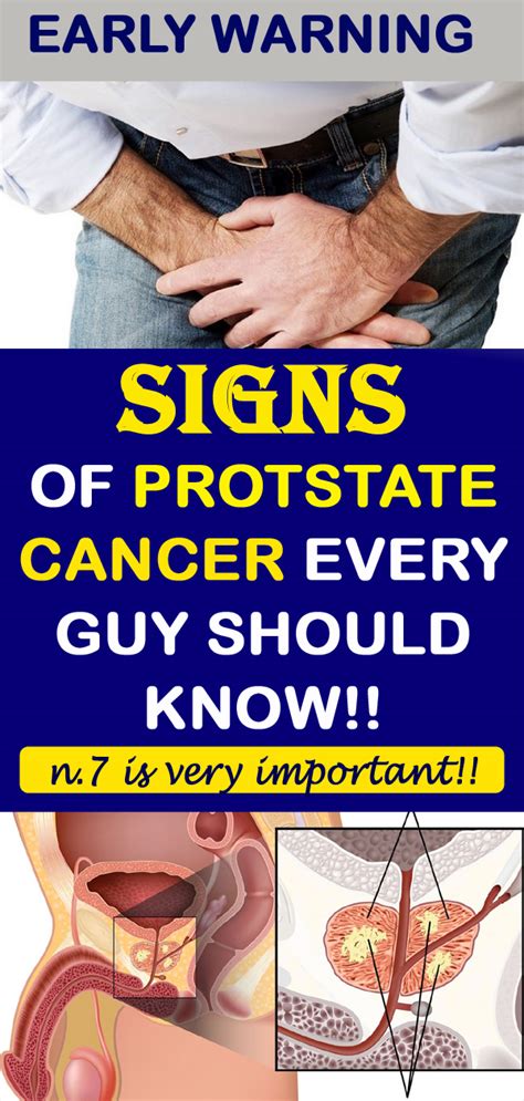 Early Warning Signs Of Prostate Cancer That Every Guy Needs To Know Nutrition Health