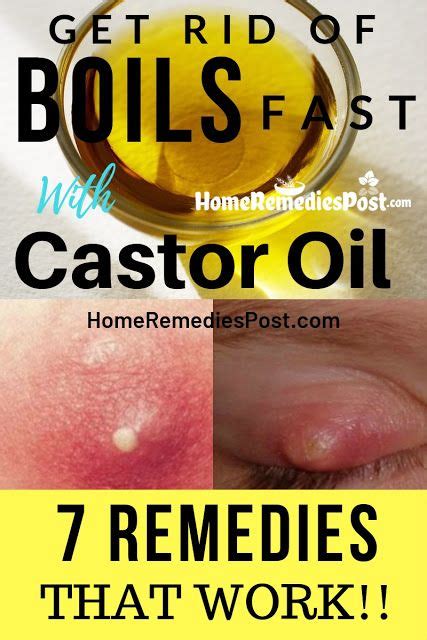 Boils On Body 7 Natural Ways To Use Castor Oil For Boils Home Remedy