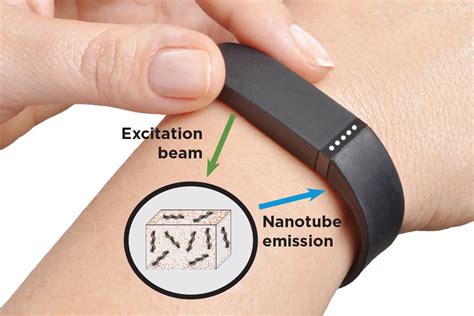 Implantable Sensors For Early Disease Detection Sloan Kettering Institute