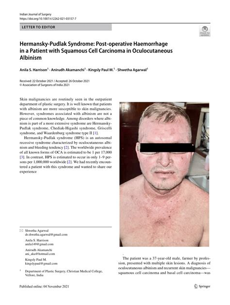 Pdf Hermansky Pudlak Syndrome Post Operative Haemorrhage In A