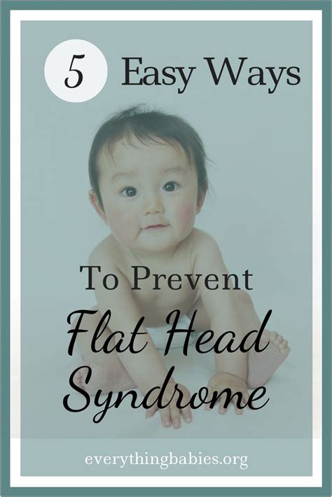 What Is Flat Head Syndrome Ask The Baby Expert ~ Question 36 Flat