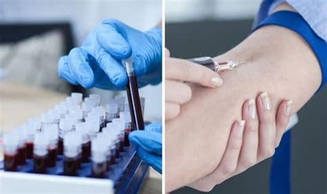 Cancer Blood Tests Trial How To Volunteer For Nhs Galleri Screening
