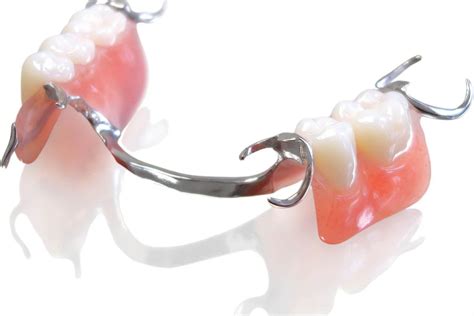 Partial Denture 4 Dental Implant Center