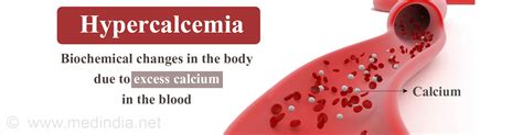 Hypercalcemia Causes Symptoms Risk Factors Diagnosis Treatment