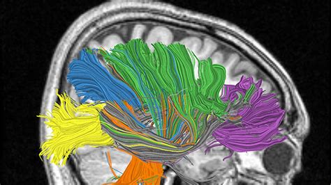 Reverse Engineering Of Human Brain Likely By 2020