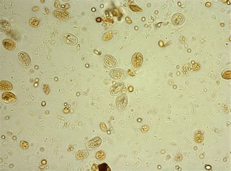 The Figure Demonstrates The Protozoic Parasite Giardia Intestinalis