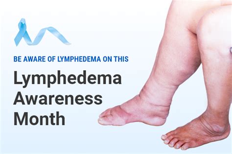 Support Lymphedema Awareness Month Lymphedema Products Blog