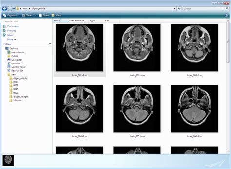 How To Open Dcm File Remember Different Programs May Use Dcm Files