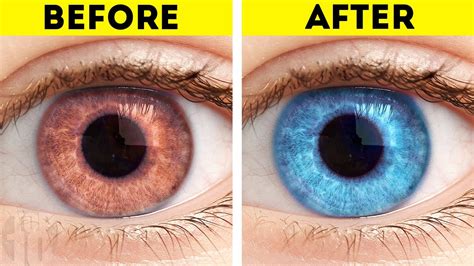 10 Things That Can Change Your Eye Color Youtube