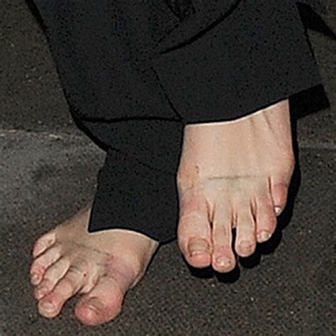 Celebs With Ugly Feet Gross Calli And Crusty Hammer Toes Peaceful