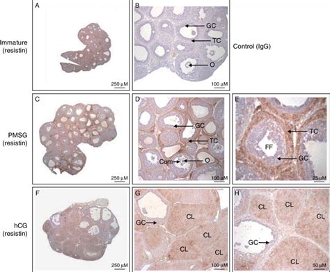 Localization Of Resistin In Rat Ovary By Immunohistochemistry Resistin