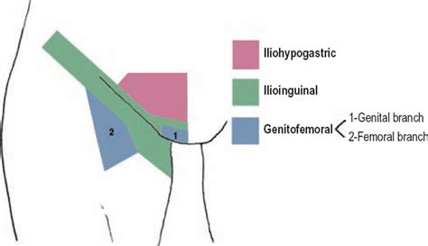 The Diagnostic Anatomy Of The Inguinal Complex Of Nerves Neupsy Key