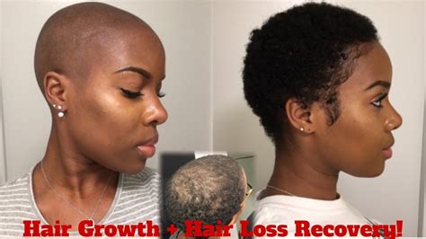 Balayagedarkhair 3 Month Hair Growth From Bald