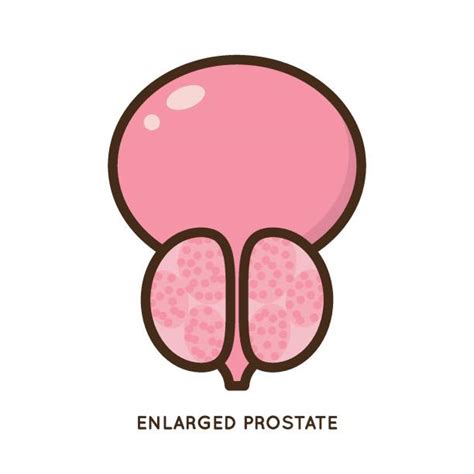 40 cartoon of a prostate gland diagram stock illustrations royalty free vector graphics and clip