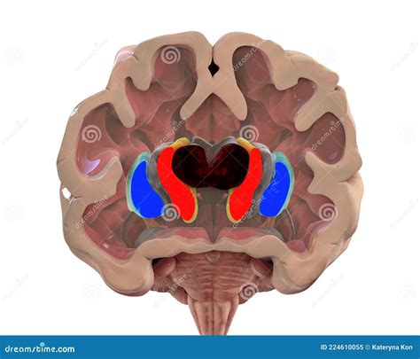 Enlarged Lateral Ventricles Of The Child Brain And Normal Ventricular