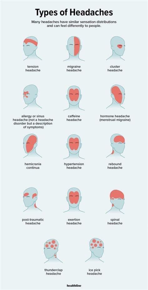 14 Kinds Of Headaches And Their Causes Daily Infographic
