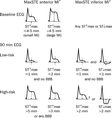Extent Of St Segment Deviation In A Single Electrocardiogram Lead 90