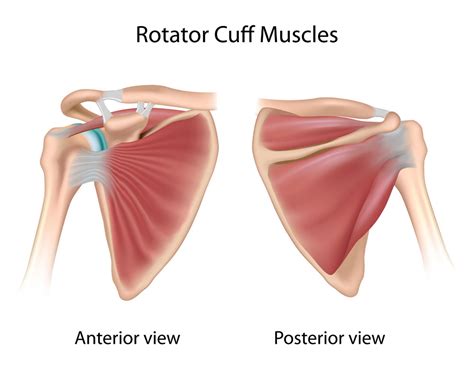 Rotator Cuff Tendonitis Shoulder Specialist Austin Round Rock