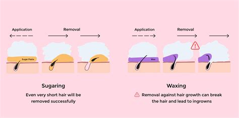 sugaring hair removal method lakisha robert